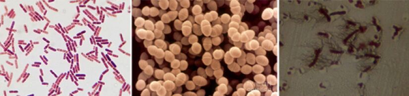 Escherichia coli, enterococcus kałowy i Proteus są głównymi czynnikami sprawczymi przewlekłego bakteryjnego zapalenia gruczołu krokowego